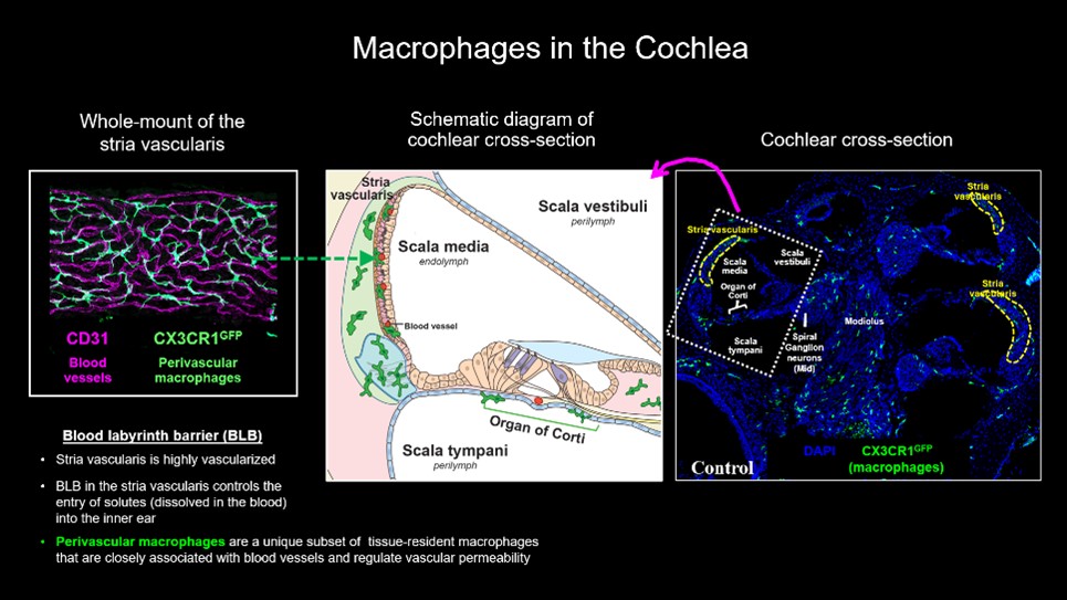 Macrophages in the Cochlea