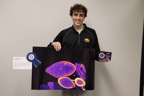 Photo of Sean Strand receiving first place People's Choice Award in the 2025 Capture Your Research Photo Contest