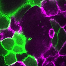 Human epidermoid carcinoma cells (A431) expressing either GFP-tagged F-actin (green) or m-Ruby-tagged E-cadherin (magenta) and migrating collectively to seal a gap in the tissue.